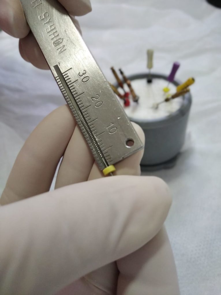 Ferramenta de dentista