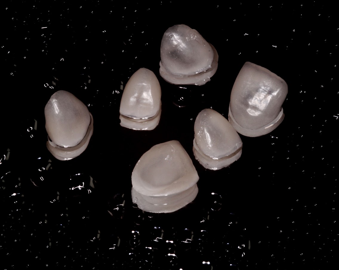 Lentes de contato odontologis